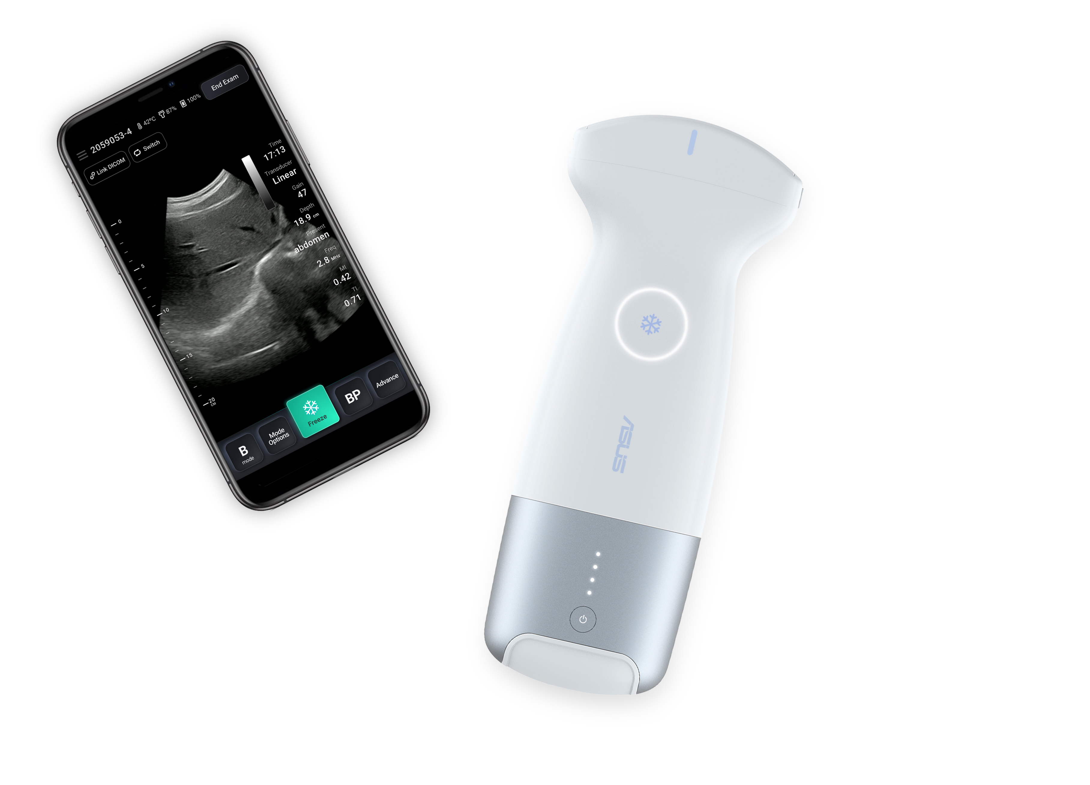 ASUS portable ultrasound solution