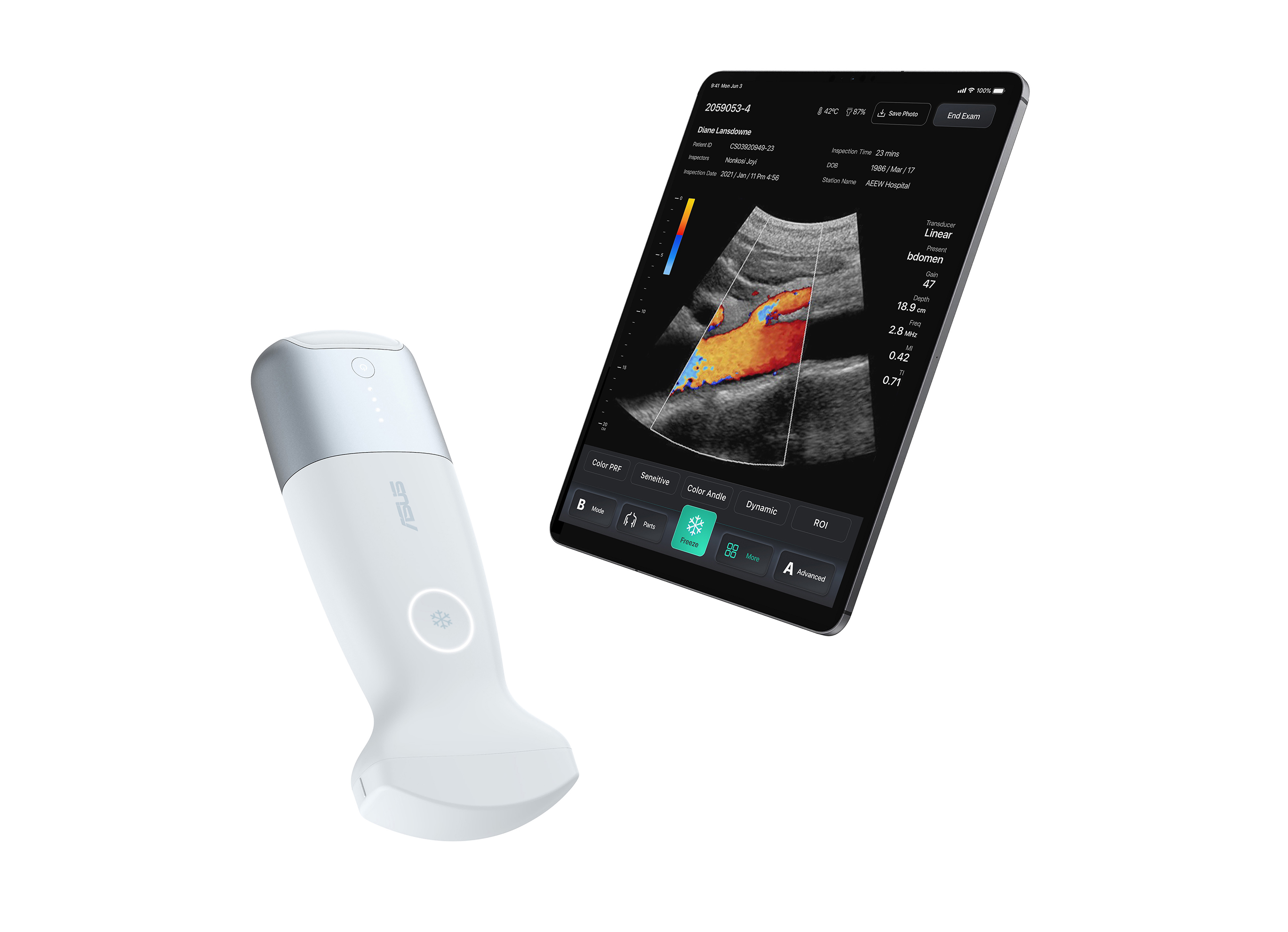 ASUS portable ultrasound solution