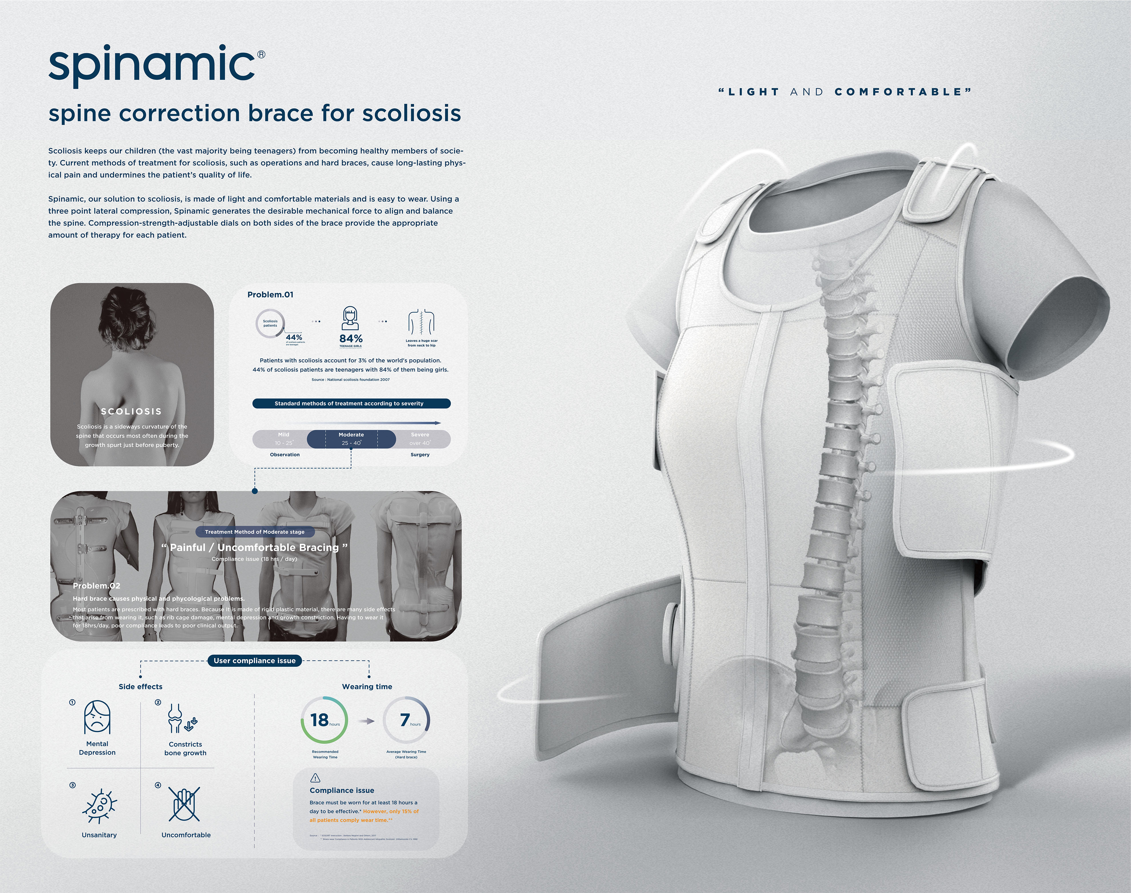 Spinamic for scoliosis patient