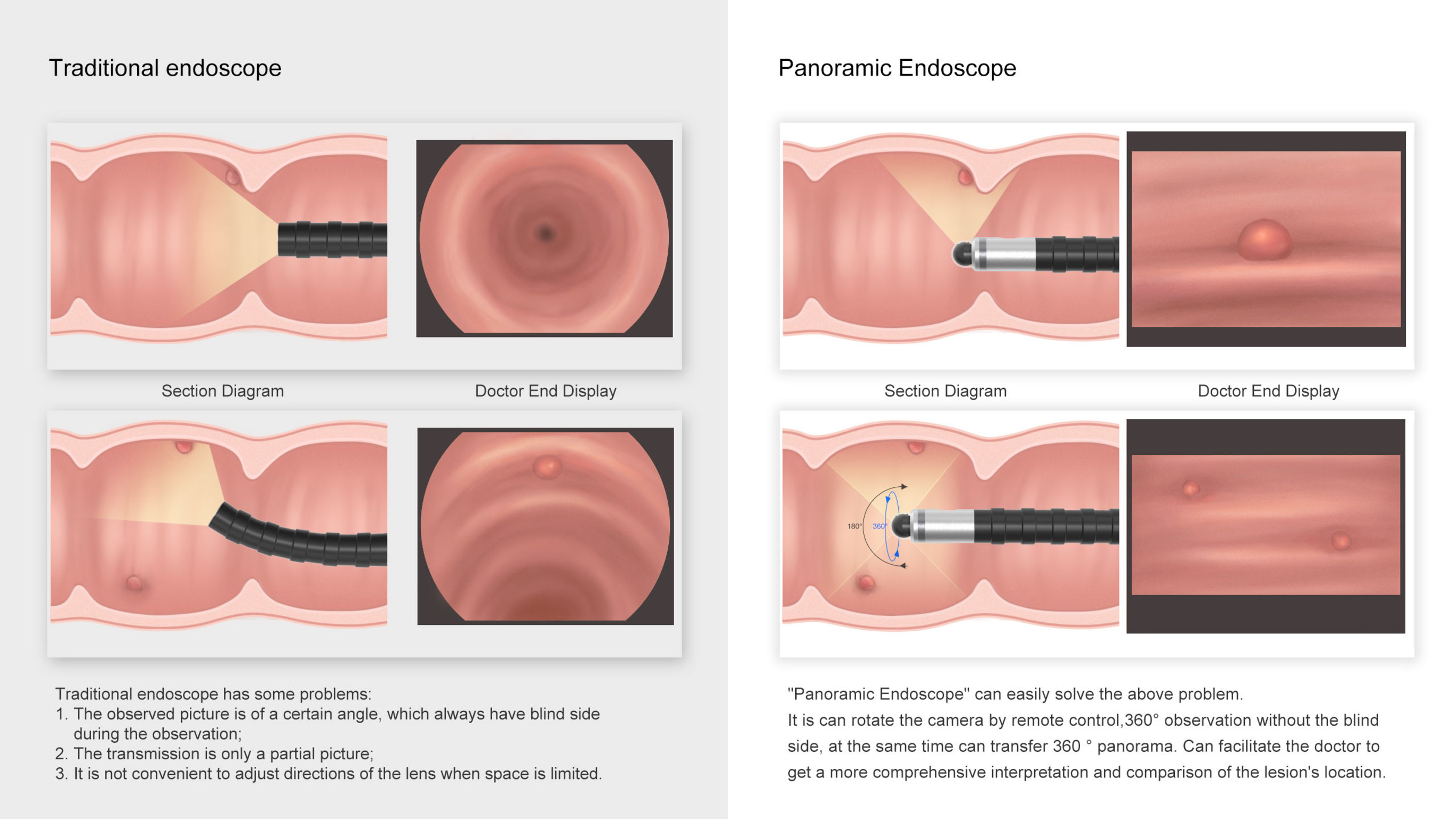 Panoramic endoscope