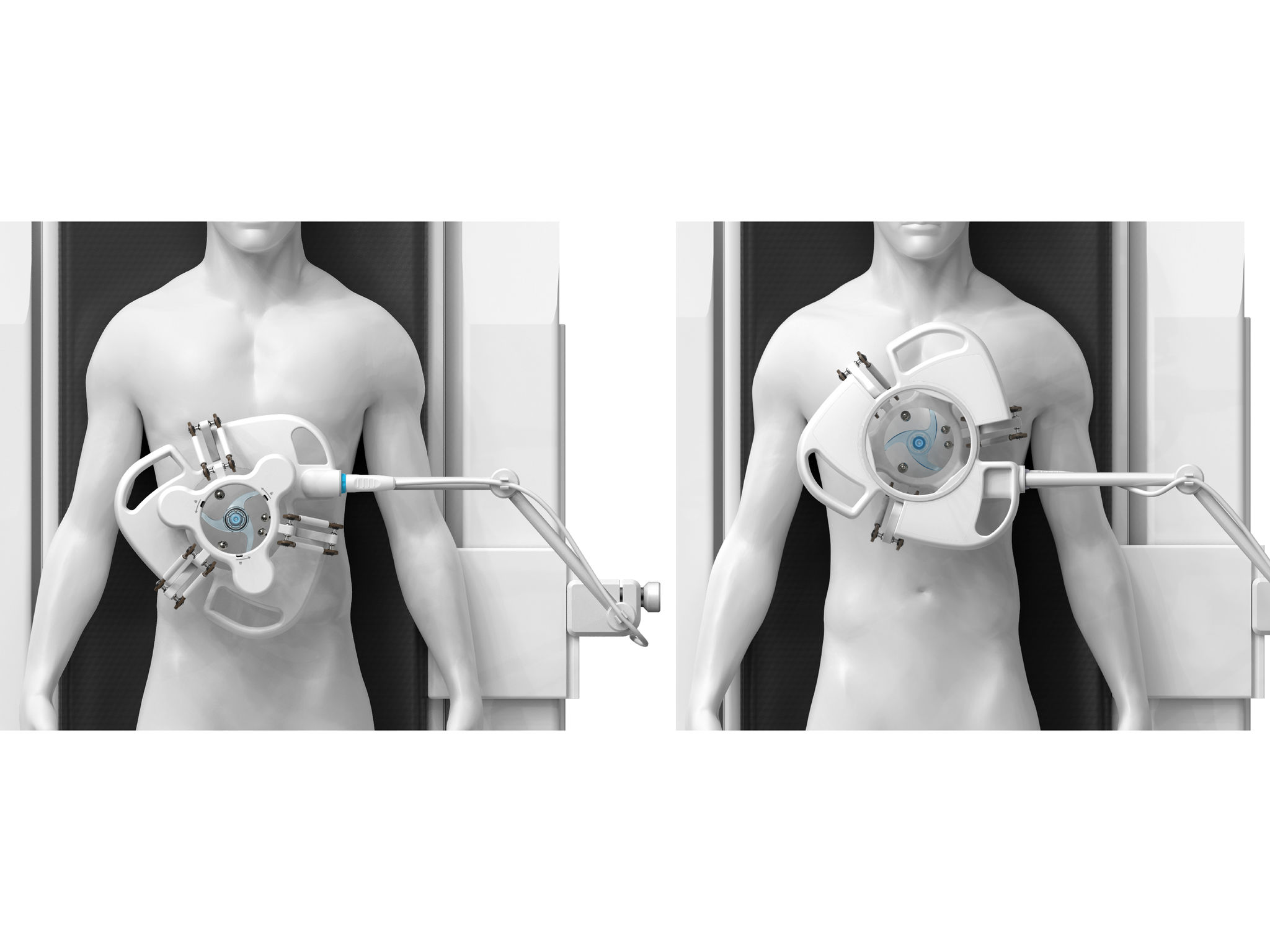 Automated Needle Targeting Robot