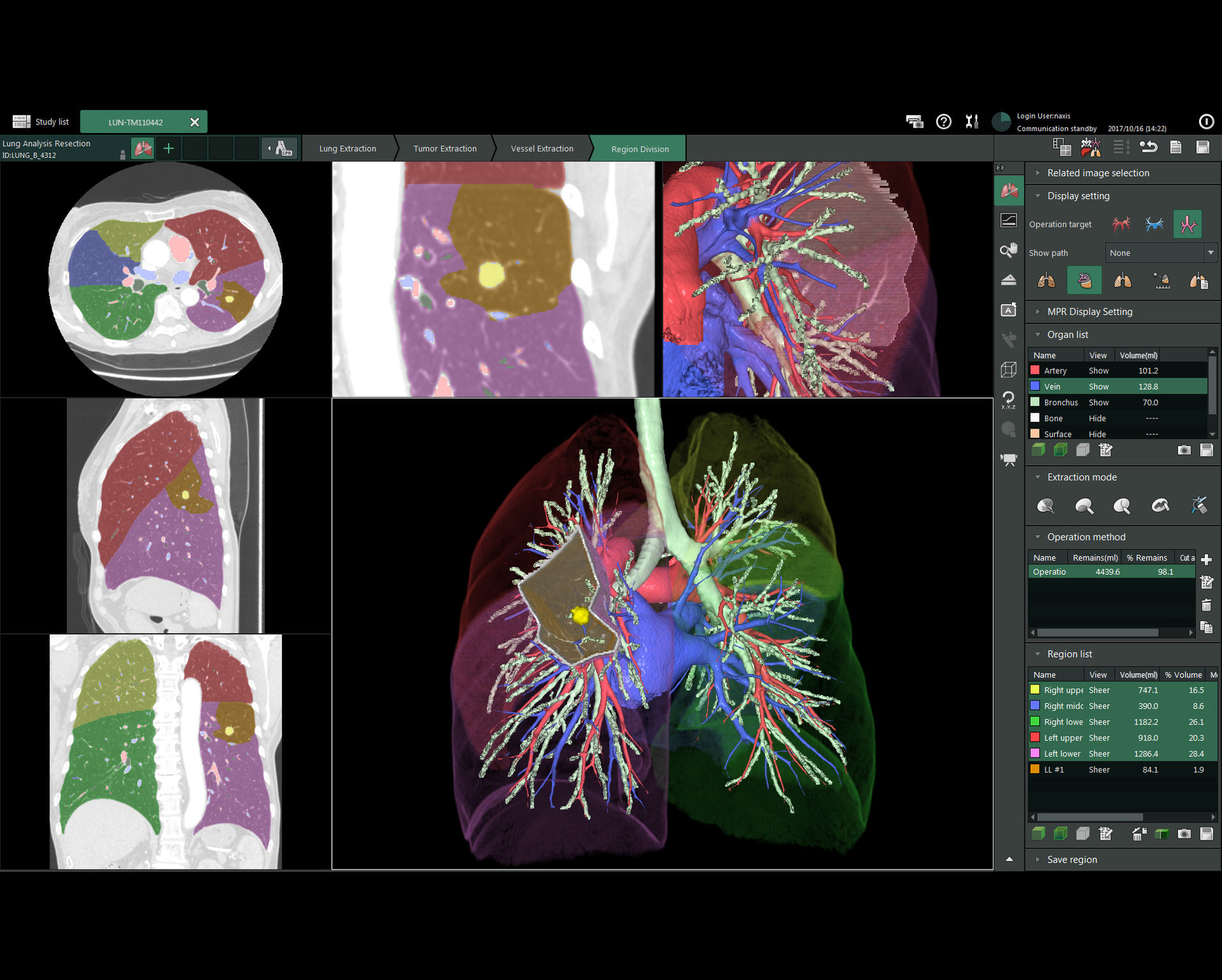 SYNAPSE 3D