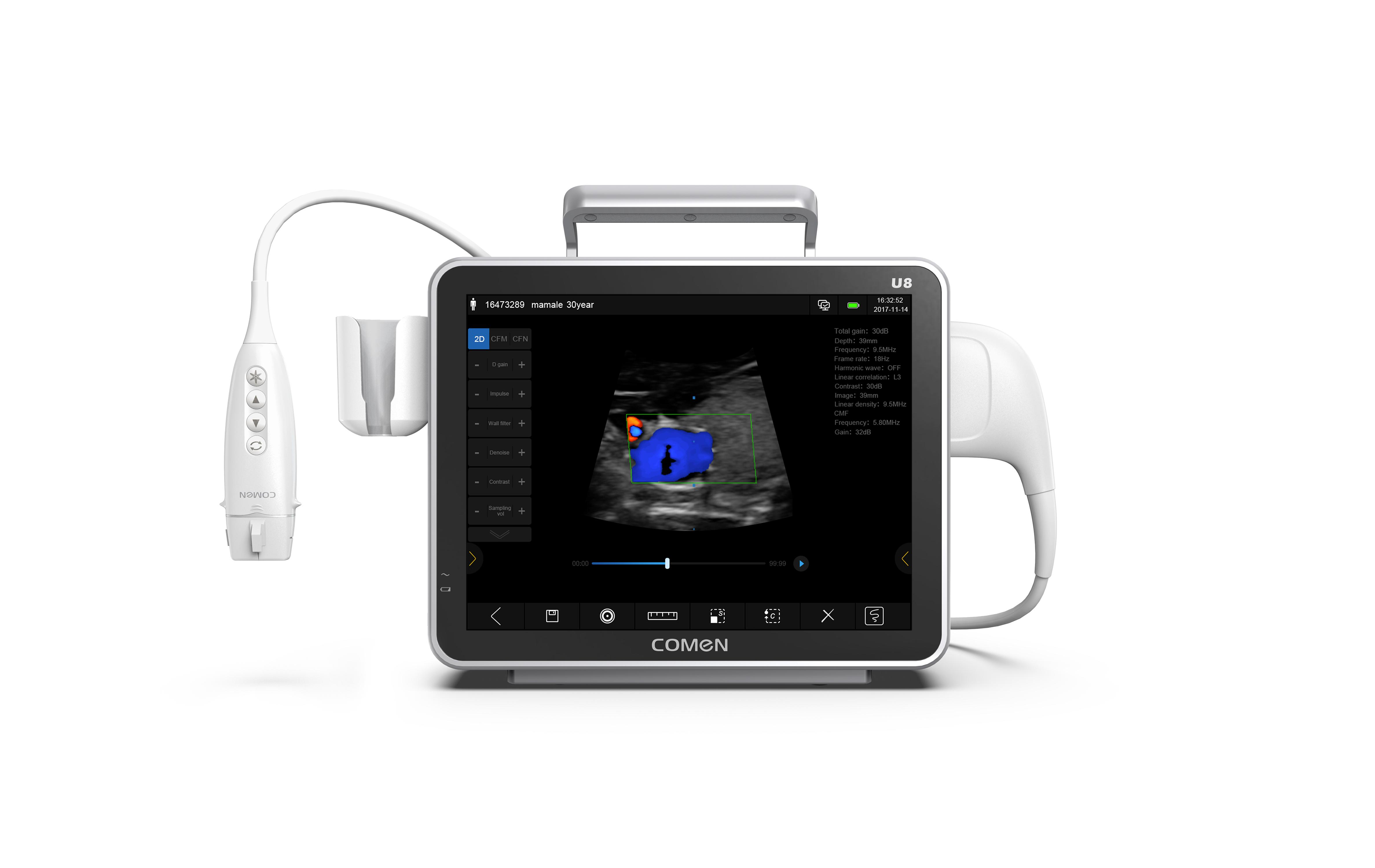 ECG Doppler Ultrasound System