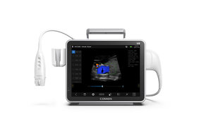 ECG Doppler Ultrasound System