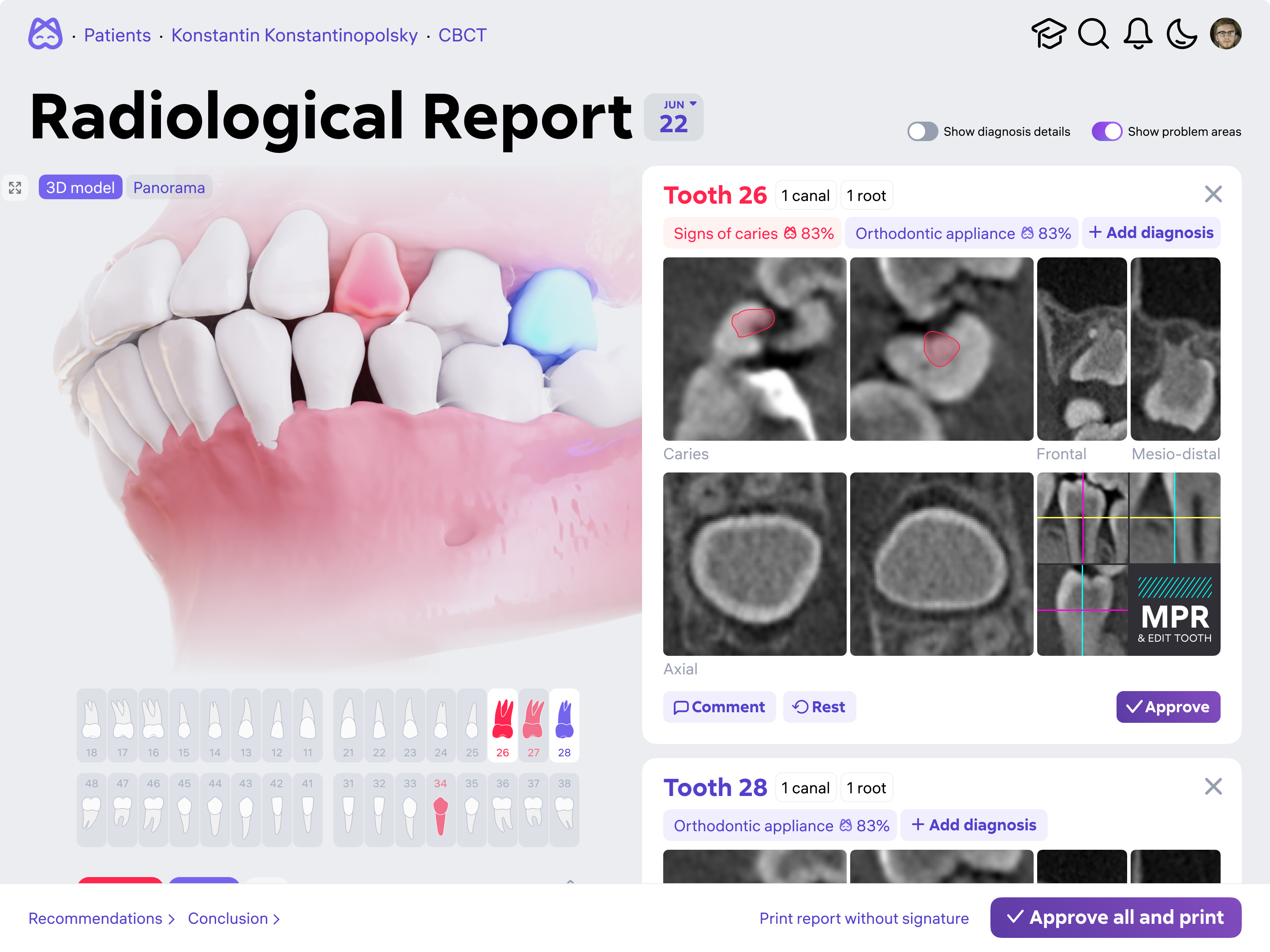 iF Design Diagnocat dental analysis system