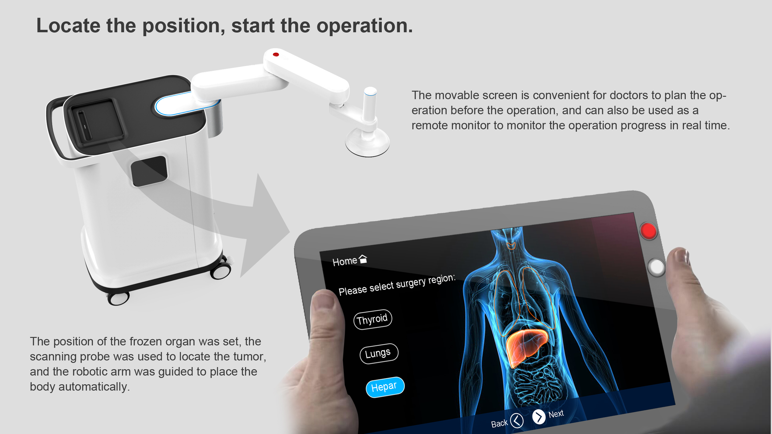 Tumor cryoablation system